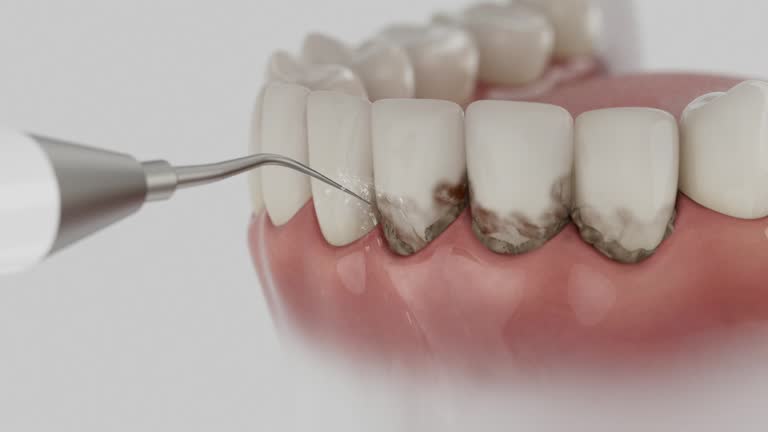 Reliable Dental Implants contractor in Pine Beach, NJ by Smile Center Dentistry